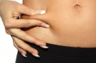 VelaShape® Treatment