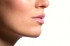 kybella® Treatment