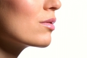 kybella® Treatment